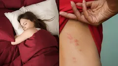 Verborgen plaagdieren in bed: hoe huisstofmijten te herkennen en effectief te bestrijden